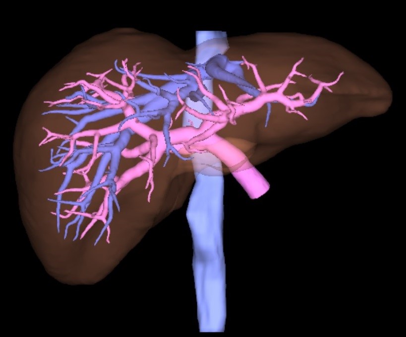 肝臓解析　3D画像 