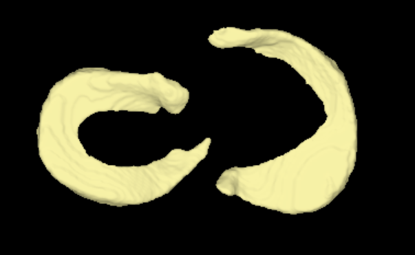 膝関節解析　3D画像